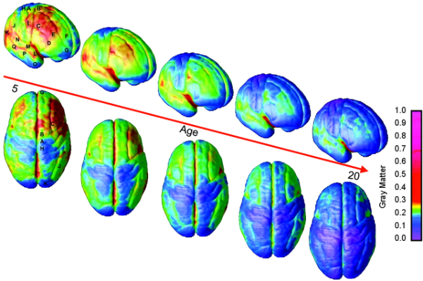 Dynamic mapping of human cortical development during childhood through early adulthood. In Gogtay N, Giedd JN, Lusk L, Hayashi KM, Greenstein D, Vaituzis AC, Nugent TF 3rd, Herman DH, Clasen LS, Toga AW, Rapoport JL, Thompson PM. (2004). Proc Natl Acad Sci U S A. May 25;101(21):8174-9.